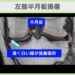 左膝半月板損傷のMRI所見（薄く白い線が損傷箇所）